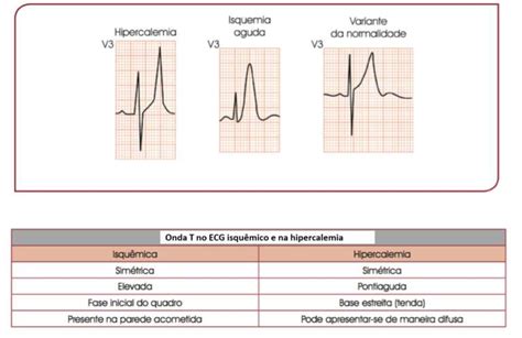 Qt Sinal De Slot Diferentes Segmentos